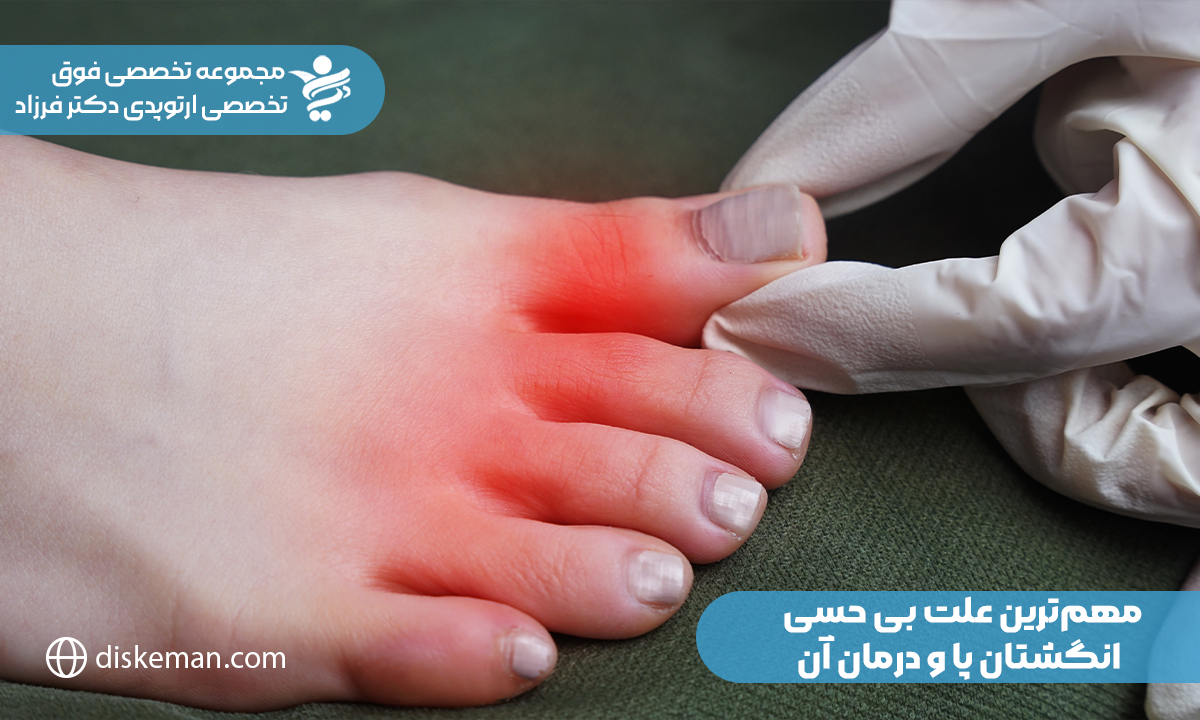 مهم‌ترین علت بی‌ حسی انگشتان پا و درمان آن